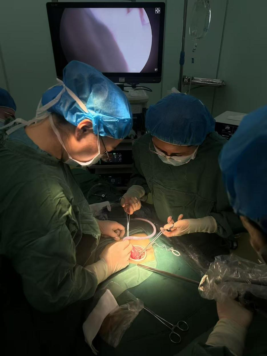 刘国艳（右）正在进行单孔腹腔镜下卵巢肿瘤剥除术带教。受访者供图